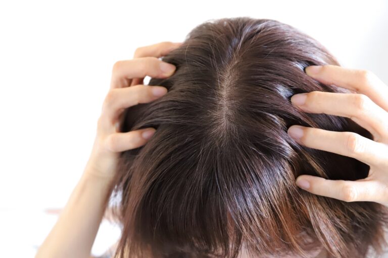 春節養髮必看！小心這5個壞習慣讓頭皮出油更嚴重
